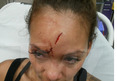 Evelyn Lozada's Bloody Head Gash After Chad Johnson Fight [PHOTOS]