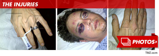 0726-jason-london-injuries-mini