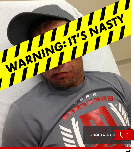 08701_fight_aftermath_caution_tape_v3