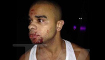 Raz B -- BOTTLE TO THE FACE ... Singer Hospitalized After Nightclub Attack