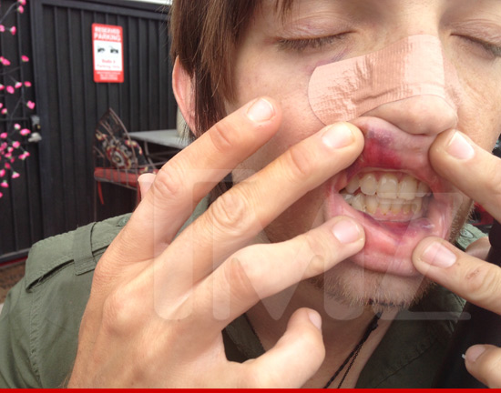 0819_alex_band_1_wm