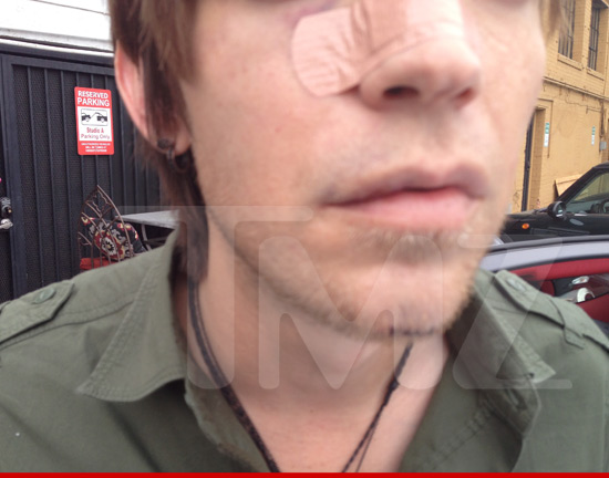 0819_alex_band_2_wm