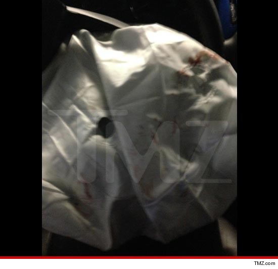 1001-Burleson-airbag-tmz