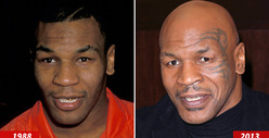 Mike Tyson -- Good Genes or Good Docs?