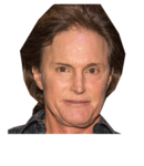 Bruce Jenner Surgeries, Facial Changes