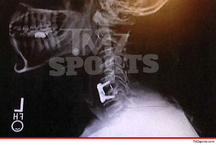 03-25-14-rob-williams-xray-tmz