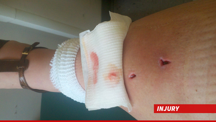 0417-the-chew-injury-01