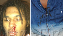 Chris Brown -- BLOODY PHOTOS From Alleged D.C. Beatdown