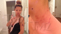 The-Dream's Baby Mama Photographed Injuries After Alleged Attack [PHOTOS]