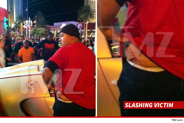 0525-mayweather-fight-wound-tmz-02