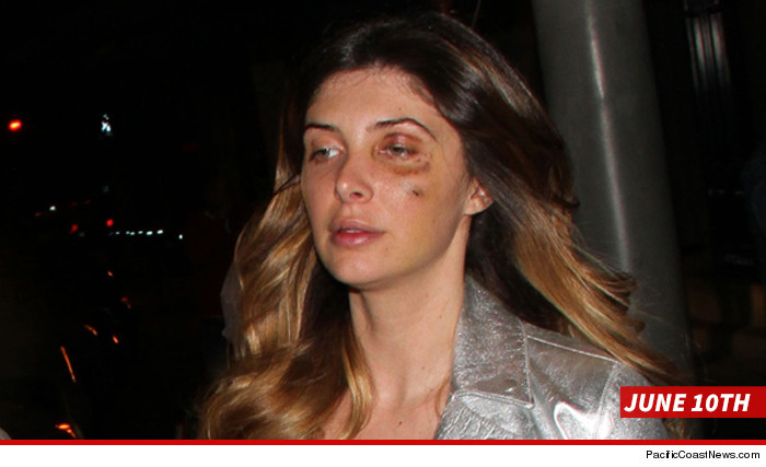 0612-brittny-gastineau-eye-sub-PCN-01