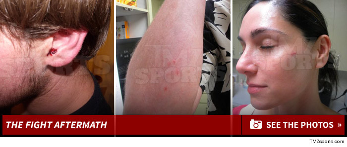 0627_hope-solo-injury-photos-footer