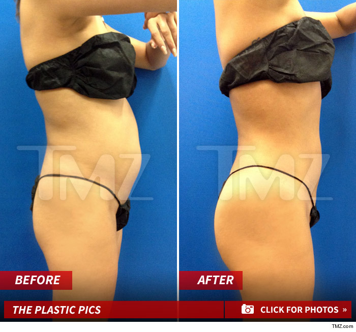 Shahs Of Sunset GG Plastic Surgery