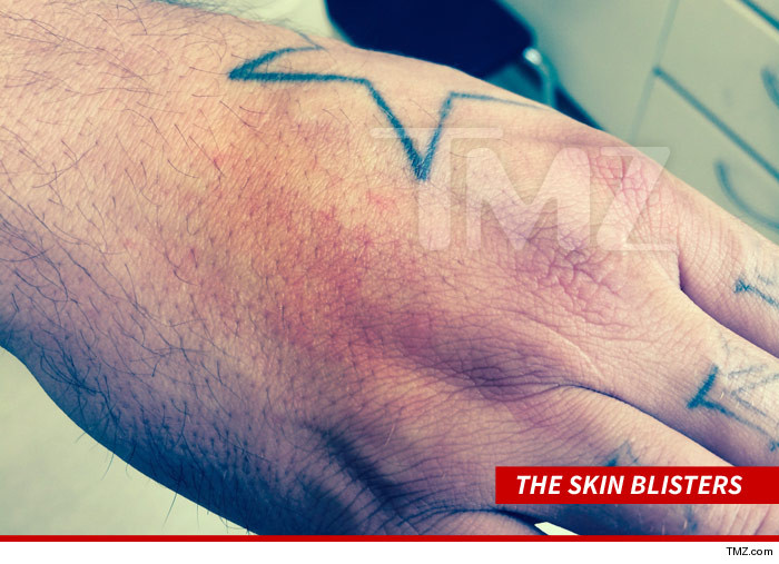 0723_sean_stewart_rash_mold_apartment_tmz_sub_v2