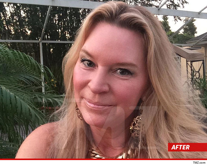 0725-jackie-siegel-after-sub-01
