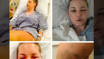 Christy Mack -- War Machine Almost Killed Me ... 18 Broken Bones, Ruptured Liver