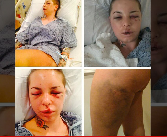 0811-christy-mack-injuries-twitter-02