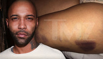 Rapper Joe Budden -- Girlfriend Says He Beat Her Rihanna Style (PHOTOS)