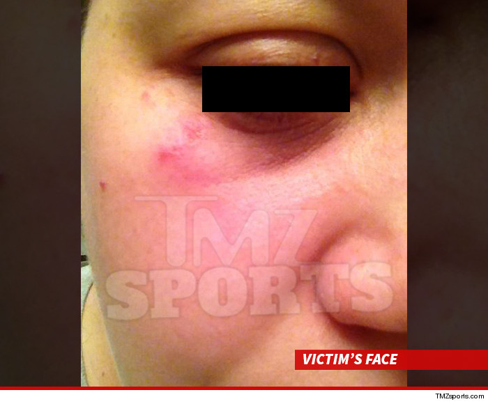 0822-isaiah-golden-victims-face-01