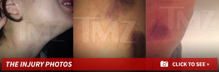 0827-joe-budden-injury-sub-gallery-01