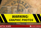 Suge Knight -- 6 Bullet Holes & Huge Surgery Scar (PHOTOS) 