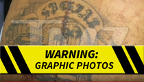Suge Knight -- 6 Bullet Holes & Huge Surgery Scar (PHOTOS) 