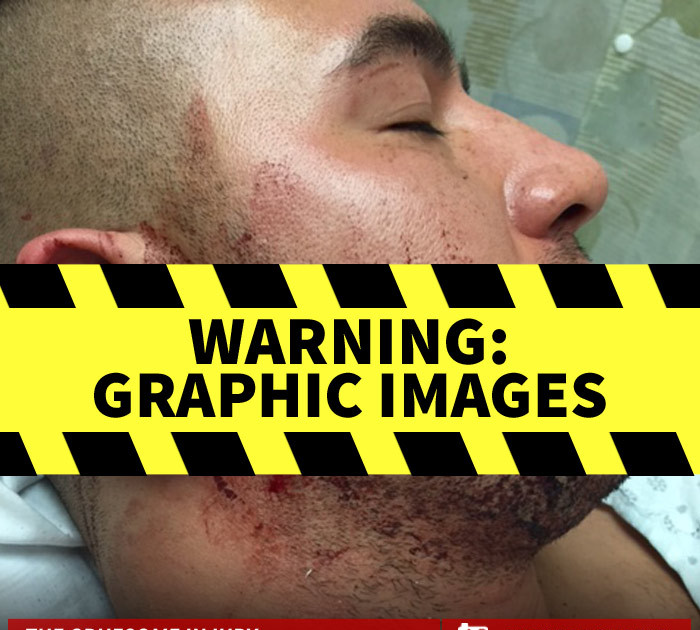 'Mob Wives' Natalie Guercio -- My Boyfriend's Lucky to Be Alive ... Gory Pics Prove It