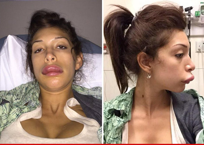 Farrah Abraham -- Pays Dearly for Lip Service