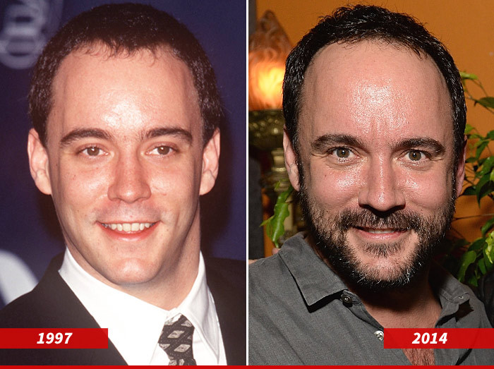 Dave Matthews: Good Genes or Good Docs?!
