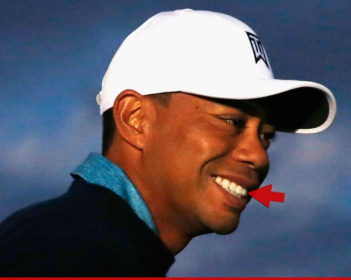 Tiger Woods -- My Tooth Is Back!