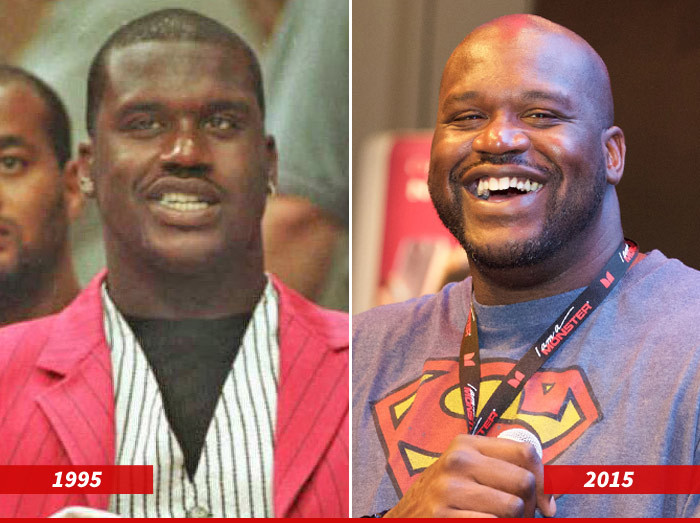 Shaquille O'Neal: Good Genes or Good Docs?!