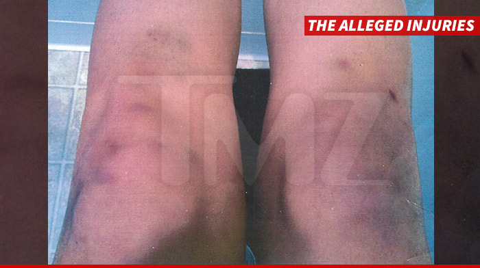 0325-mark-salling-roxanne-gorzela-INJURIES-SUB-TMZ-01