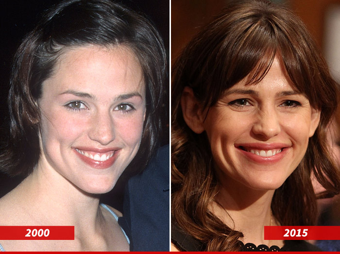 Jennifer Garner: Good Genes Or Good Docs?!