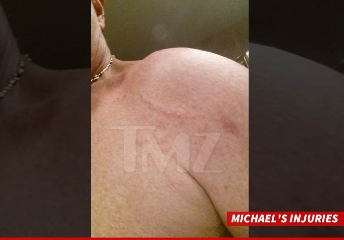 0417-michael-lohan-injury-tmz