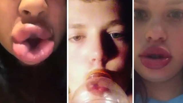 Kylie Jenner -- Girls Want Her Fat Lips (VIDEO)