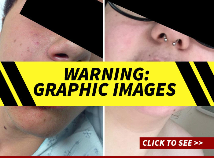 Kylie Jenner -- Lip Challenge Gone Way Wrong ... People Are Pissed And Seriously Injured (PHOTOS)