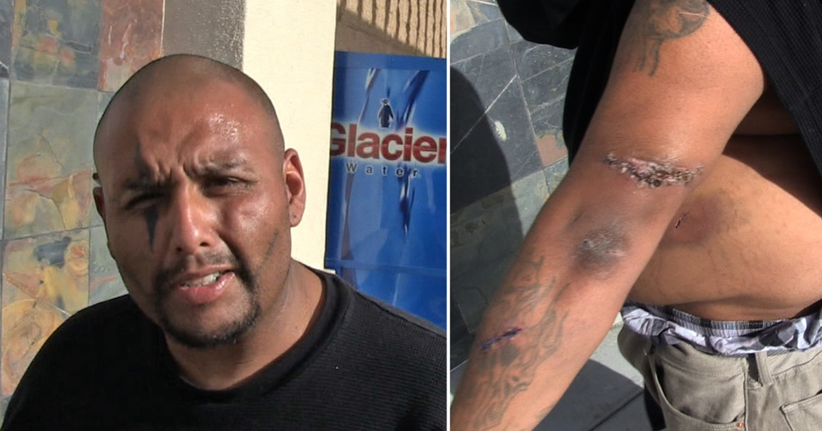 Jeremy Jackson -- Stabbing Victim Shows Gnarly Wounds