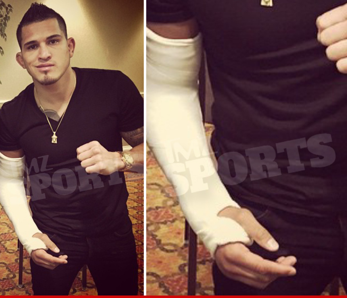 UFC's Anthony Pettis -- I May Have Busted Elbow ... But I'm Still Fighting Wrinkles!