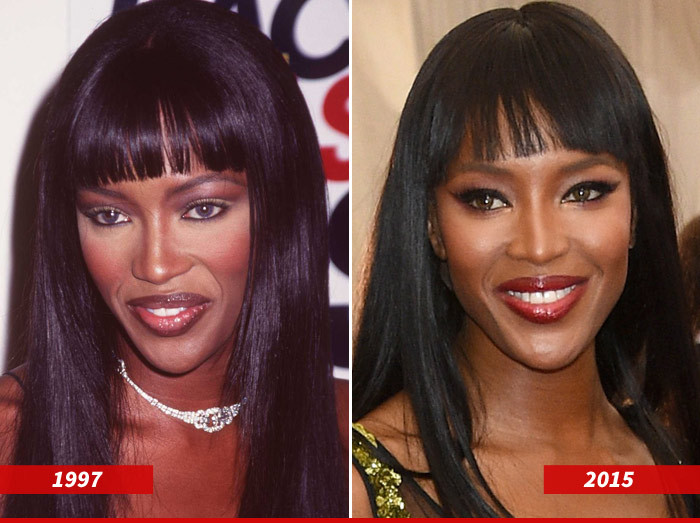 Naomi Campbell: Good Genes Or Good Docs?