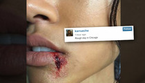 Karrueche Tran -- Oh, That Bloody Lip? It's Just ... (PHOTO)