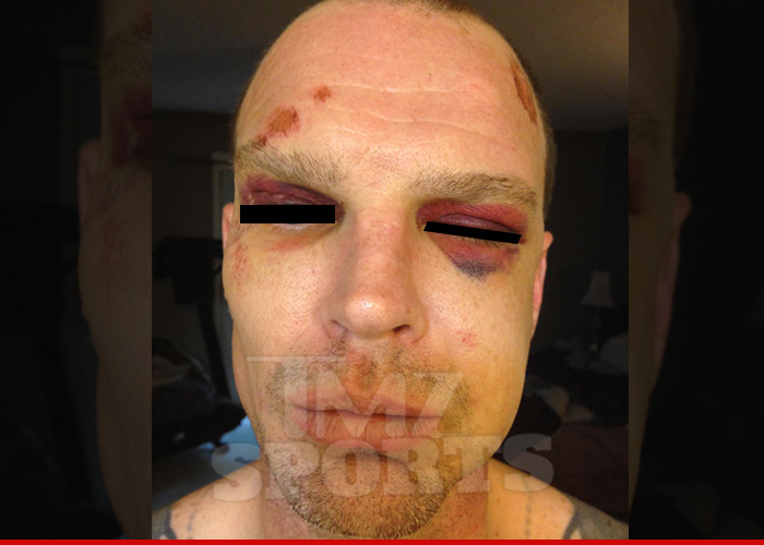 Jermain Taylor -- Brutal Photos of Alleged Beating Victim