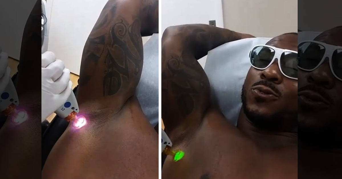 NFL's Willis McGahee -- I'm Lasering My Armpits ... And Proud Of It!!!