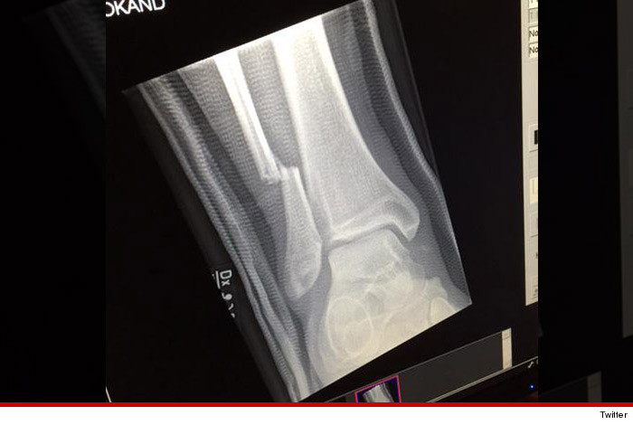 0612_Dave_grohl_XRAY_twitter