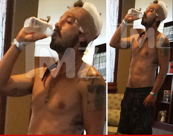 Shia LaBeouf -- My Head Is So Jacked Up ... After Stunt Disaster (PHOTO)
