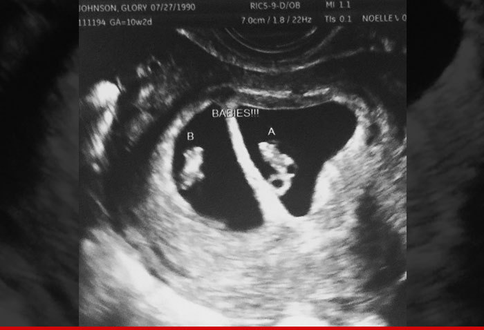 WNBA's Glory Johnson -- I'M HAVING TWINS ... With or Without Brittney