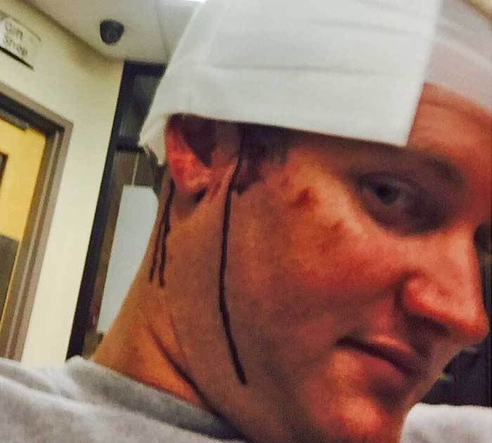 'Bachelorette' Star Shawn Evans -- Another Reality Star Bricked Me in the Head