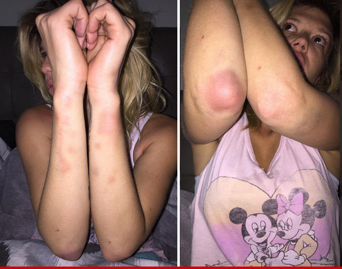 Chanel West Coast -- I Was Brutalized During Arrest (PHOTOS)