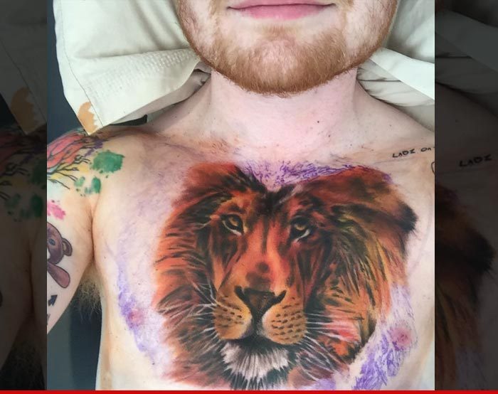 Ed Sheeran X Tattoo | ed sheeran x marks the spot of the worst tattoo Ed Sheeran X Tattoo | ed sheeran x marks the spot of the worst tattoo