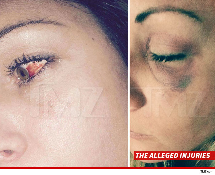 0821-ivan-moody-alleged-injuries-victim-TMZ-01