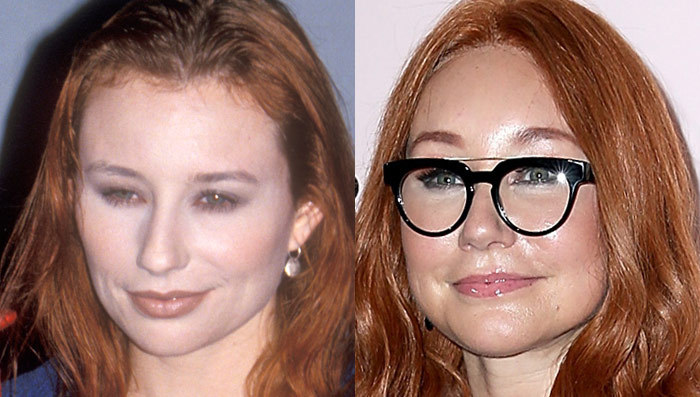Tori Amos: Good Genes or Good Docs?!